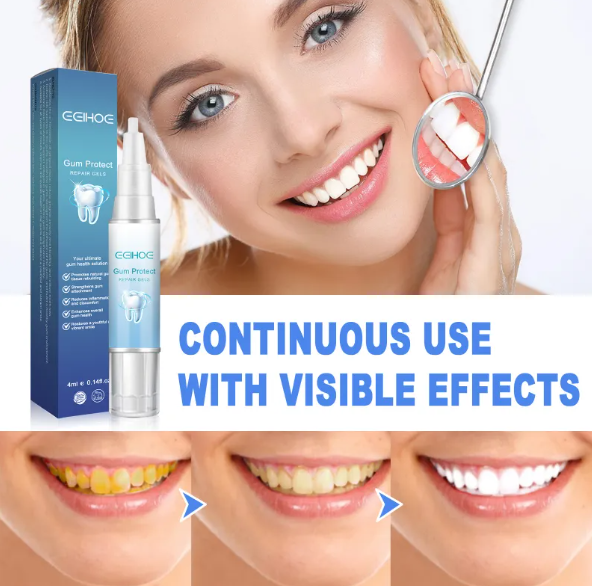 Teeth Repair Gel by Geo’s Online Store