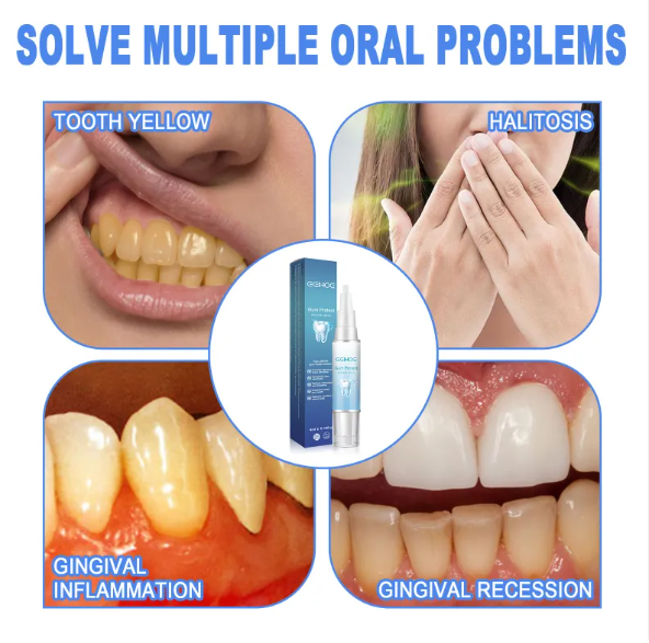 Teeth Repair Gel by Geo’s Online Store
