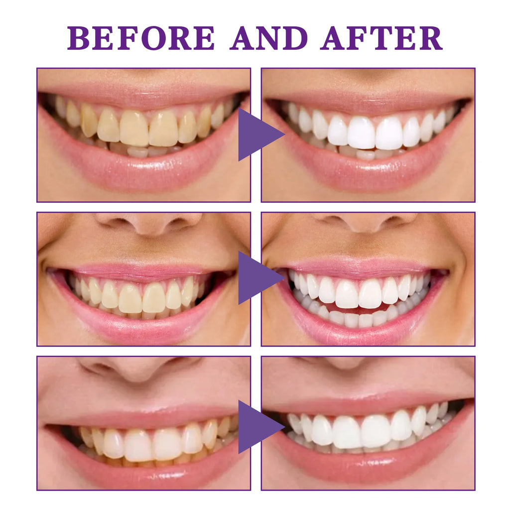 V34 Tooth Cleaning Mousse by Geo’s Online Store
