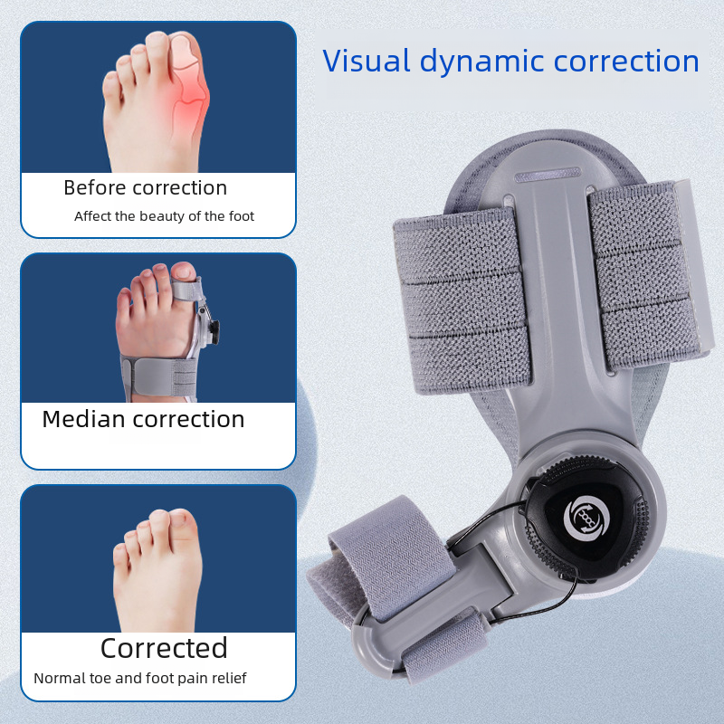Upgraded Adjustable Bunion Corrector by Geo’s Online Store