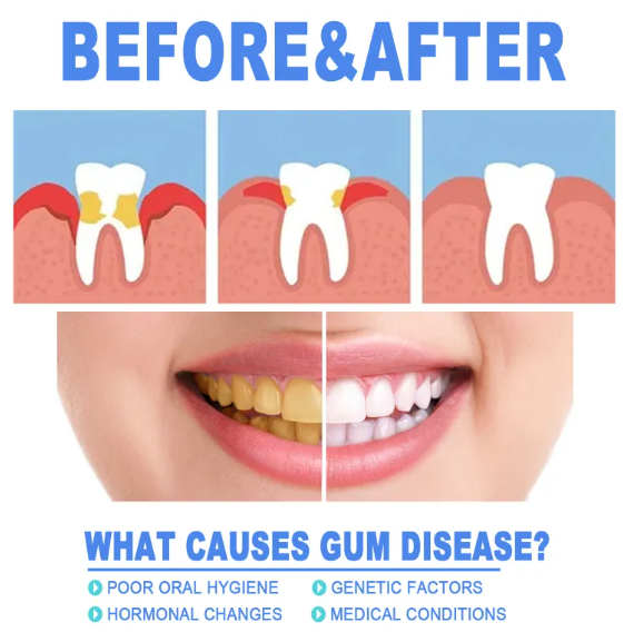 Teeth Repair Gel by Geo’s Online Store