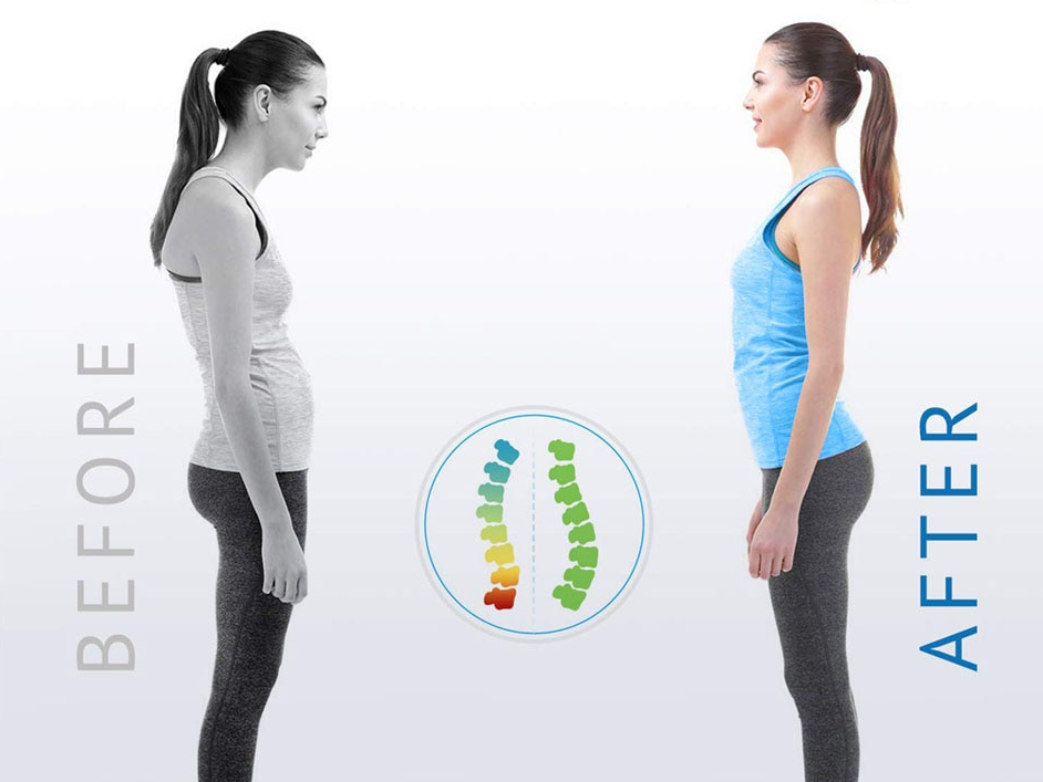 Posture Corrector by Geo’s Online Store
