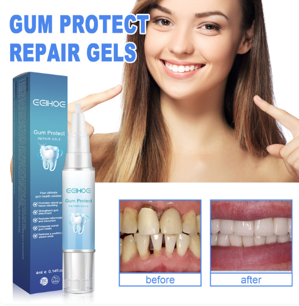 Teeth Repair Gel by Geo’s Online Store